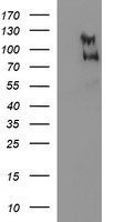 HEK293T cells were transfected with the pCMV6-ENTRY control (Left lane) or pCMV6-ENTRY CEP68 (Right lane) cDNA for 48 hrs and lysed. Equivalent amounts of cell lysates (5 ug per lane) were separated by SDS-PAGE and immunoblotted with anti-CEP68.