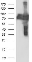 HEK293T cells were transfected with the pCMV6-ENTRY control (Left lane) or pCMV6-ENTRY CEP68 (Right lane) cDNA for 48 hrs and lysed. Equivalent amounts of cell lysates (5 ug per lane) were separated by SDS-PAGE and immunoblotted with anti-CEP68.