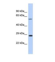 Western blot of Human Placenta . CEP70 antibody dilution 1.0 ug/ml.