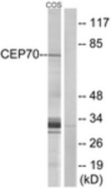 Western blot of extracts from COS cells, using CEP70 Antibody. The lane on the right is treated with the synthesized peptide.