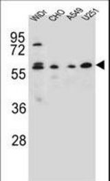CEP70 Antibody western blot of WiDr,CHO,A549,U251 cell line lysates (35 ug/lane). The CEP70 antibody detected the CEP70 protein (arrow).