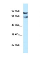CEP76 antibody LS-C145848 Western blot of Fetal Lung lysate. Antibody concentration 1 ug/ml.