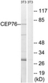 Western blot of extracts from NIH-3T3 cells, using CEP76 Antibody. The lane on the right is treated with the synthesized peptide.