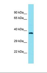Western blot of Human OVCAR-3. CEP89 antibody dilution 1.0 ug/ml.
