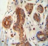 CEPT1 antibody immunohistochemistry of formalin-fixed and paraffin-embedded human breast tissue followed by peroxidase-conjugated secondary antibody and DAB staining.