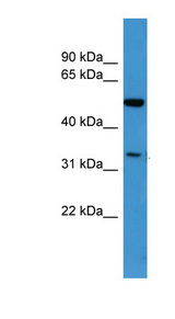CERKL antibody LS-C135635 Western blot of ACHN lysate.