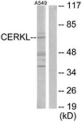 Western blot of extracts from A549 cells, using CERKL Antibody. The lane on the right is treated with the synthesized peptide.
