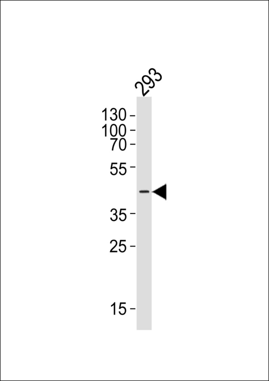 Western blot of lysate from 293 cell line with CERKL Antibody. Antibody was diluted at 1:1000. A goat anti-rabbit IgG H&L (HRP) at 1:5000 dilution was used as the secondary antibody. Lysate at 35 ug.