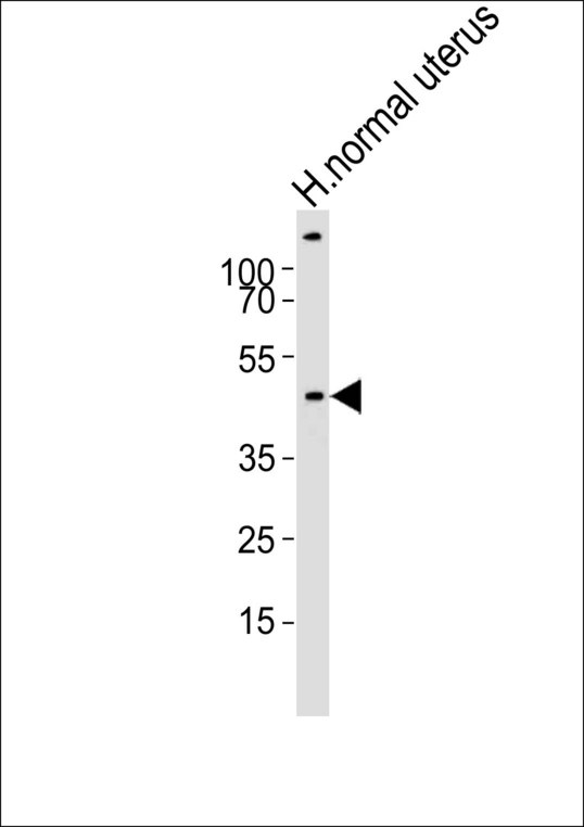 Western blot of lysate from human normal uterus tissue lysate with CERKL Antibody. Antibody was diluted at 1:1000. A goat anti-rabbit IgG H&L (HRP) at 1:10000 dilution was used as the secondary antibody. Lysate at 20 ug.