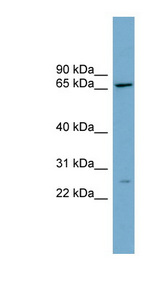 CES2 / Esterase antibody LS-C110716 Western blot of THP-1 cell lysate.