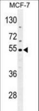 CES2 Antibody western blot of MCF-7 cell line lysates (35 ug/lane). The CES2 antibody detected the CES2 protein (arrow).