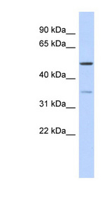 CETP antibody LS-C111325 Western blot of Fetal Thymus lysate.
