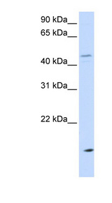 CETP antibody LS-C111324 Western blot of MCF7 cell lysate.