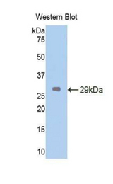 Western blot of recombinant CETP.
