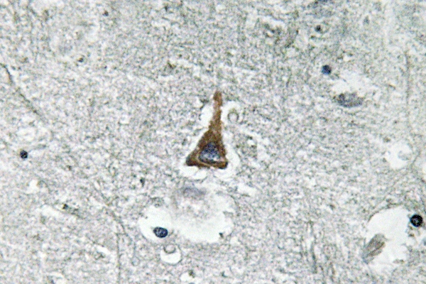 IHC of ADM (N100) pAb in paraffin-embedded human brain tissue.