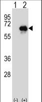 Western blot of CETP (arrow) using rabbit polyclonal CETP Antibody. 293 cell lysates (2 ug/lane) either nontransfected (Lane 1) or transiently transfected (Lane 2) with the CETP gene.