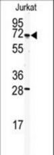 Western blot of anti-CETP Antibody in Jurkat cell line lysates (35 ug/lane). CETP (arrow) was detected using the purified antibody.