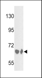 Western blot of BF Antibody in HepG2 cell line and mouse liver tissue lysates (35 ug/lane). BF (arrow) was detected using the purified antibody.