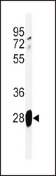 Western blot of ADM Antibody in mouse lung tissue lysates (35 ug/lane). ADM (arrow) was detected using the purified antibody.
