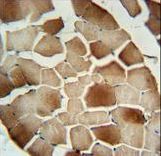 CFB Antibody immunohistochemistry of formalin-fixed and paraffin-embedded human skeletal muscle followed by peroxidase-conjugated secondary antibody and DAB staining.