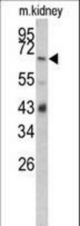 Western blot of CFB Antibody in mouse kidney tissue lysates (35 ug/lane). CFB (arrow) was detected using the purified antibody.