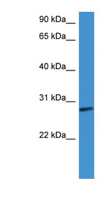 CFD / Adipsin antibody LS-C135735 Western blot of Fetal lung lysate.