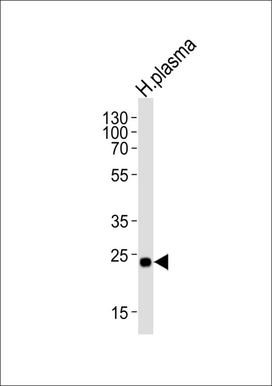 Western blot of lysate from human plasma tissue lysate, using CFD Antibody. Antibody was diluted at 1:1000. A goat anti-rabbit IgG H&L (HRP) at 1:5000 dilution was used as the secondary antibody. Lysate at 35ug.