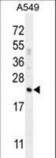 CFD Antibody western blot of A549 cell line lysates (35 ug/lane). The CFD antibody detected the CFD protein (arrow).