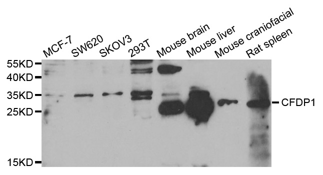 Western blot analysis of extracts of various cell lines, using CFDP1 antibody.
