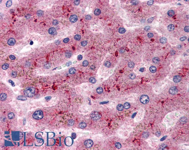 Anti-Factor H antibody IHC of human liver. Immunohistochemistry of formalin-fixed, paraffin-embedded tissue after heat-induced antigen retrieval. Antibody LS-B2585 concentration 5 ug/ml.