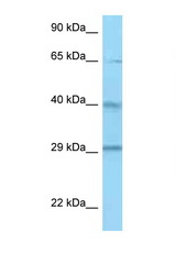 CFHR1 / CFHL1 antibody LS-C146532 Western blot of ACHN Cell lysate. Antibody concentration 1 ug/ml.