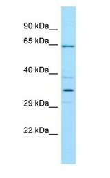 CFHR5 antibody Western Blot of THP-1.