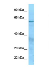 CFI / Factor I antibody LS-C146370 Western blot of HeLa Cell lysate. Antibody concentration 1 ug/ml.