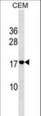 ADM2 Antibody western blot of CEM cell line lysates (35 ug/lane). The ADM2 antibody detected the ADM2 protein (arrow).