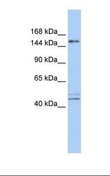 Fetal brain lysate. Antibody concentration: 1.0 ug/ml. Gel concentration: 6-18%.