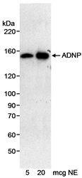 Detection of Human ADNP in nuclear extracts of HeLa cells by Western blotting using Rabbit anti-Human ADNP (LS-C43049).