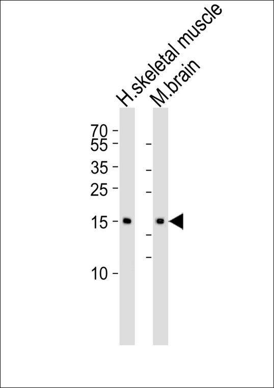 Western blot of lysates from human skeletal muscle and mouse brain tissue lysate (from left to right) with CFL2 Antibody. Antibody was diluted at 1:1000 at each lane. A goat anti-rabbit IgG H&L (HRP) at 1:5000 dilution was used as the secondary antibody. Lysates at 35 ug per lane.