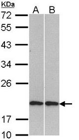 Sample (30 ug of whole cell lysate). A: H1299, B: Molt-4 . 12% SDS PAGE. Cofilin 2 antibody diluted at 1:1000.