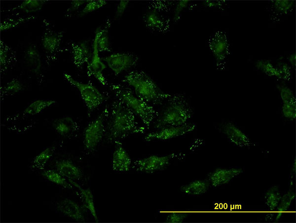 Immunofluorescence of monoclonal antibody to CFL2 on HeLa cell. [antibody concentration 10 ug/ml]