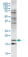CFL2 monoclonal antibody (M03), clone 6G9 Western blot of CFL2 expression in HeLa.