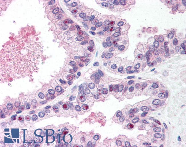 Anti-ADNP antibody IHC of human prostate. Immunohistochemistry of formalin-fixed, paraffin-embedded tissue after heat-induced antigen retrieval. Antibody LS-B61 concentration 5 ug/ml.