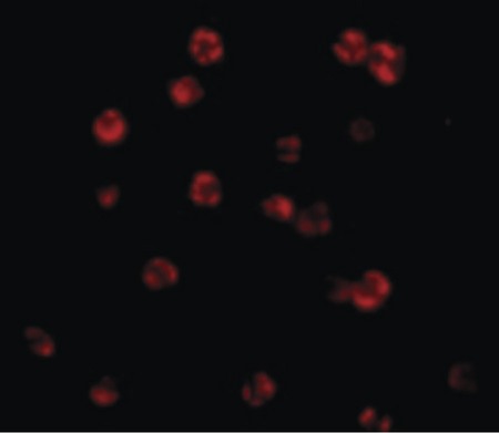 Immunofluorescence of FLIP in HeLa cells with FLIP antibody at 20 ug/ml.