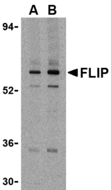 Western blot of FLIP in K562 cell lysate with FLIP antibody at (A) 1 and (B) 2 ug/ml.