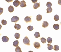 Immunocytochemistry of FLIPa in Jurkat cells with FLIPa antibody at 10 ug/ml.