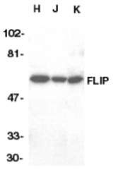 Western blot of FLIP in HeLa (H), Jurkat (J), and K562 (K) whole cell lysate with FLIP antibody at 0.5 ug/ml.