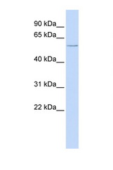 CFLAR / FLIP antibody LS-C112278 Western blot of 721_B Cell lysate. Antibody concentration 1 ug/ml.