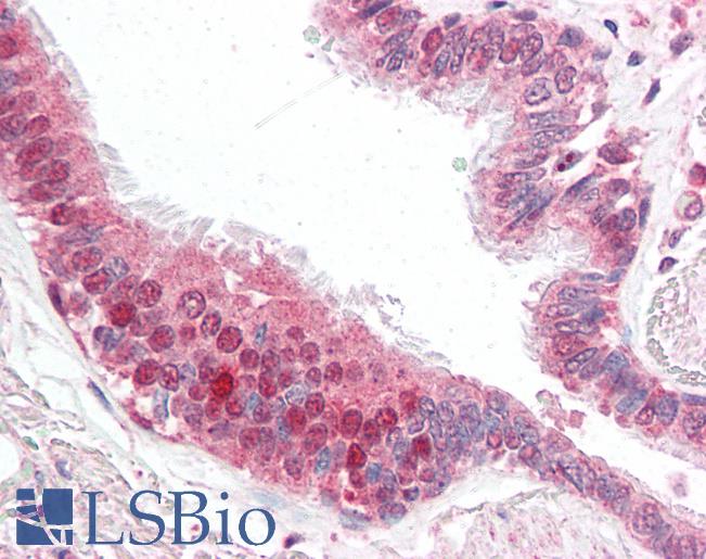 Anti-CFLAR / FLIP antibody IHC of human lung. Immunohistochemistry of formalin-fixed, paraffin-embedded tissue after heat-induced antigen retrieval. Antibody LS-B3187 concentration 5 ug/ml.