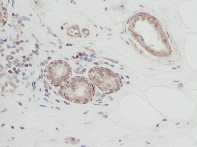 IHC of CT-1 / Cardiotrophin-1 antibody LS-C104623