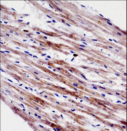 CTF1 Antibody immunohistochemistry of formalin-fixed and paraffin-embedded human heart tissue followed by peroxidase-conjugated secondary antibody and DAB staining.