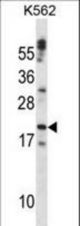 CTF1 Antibody western blot of K562 cell line lysates (35 ug/lane). The CTF1 antibody detected the CTF1 protein (arrow).